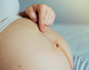 Pregnant Women having dark lines on the stomach
