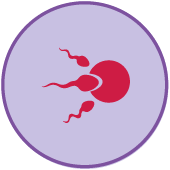 Sperm motility is the ability of sperm to move or swim